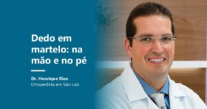 Dedo em martelo: Dr. Henrique Rios, ortopedista em São Luís