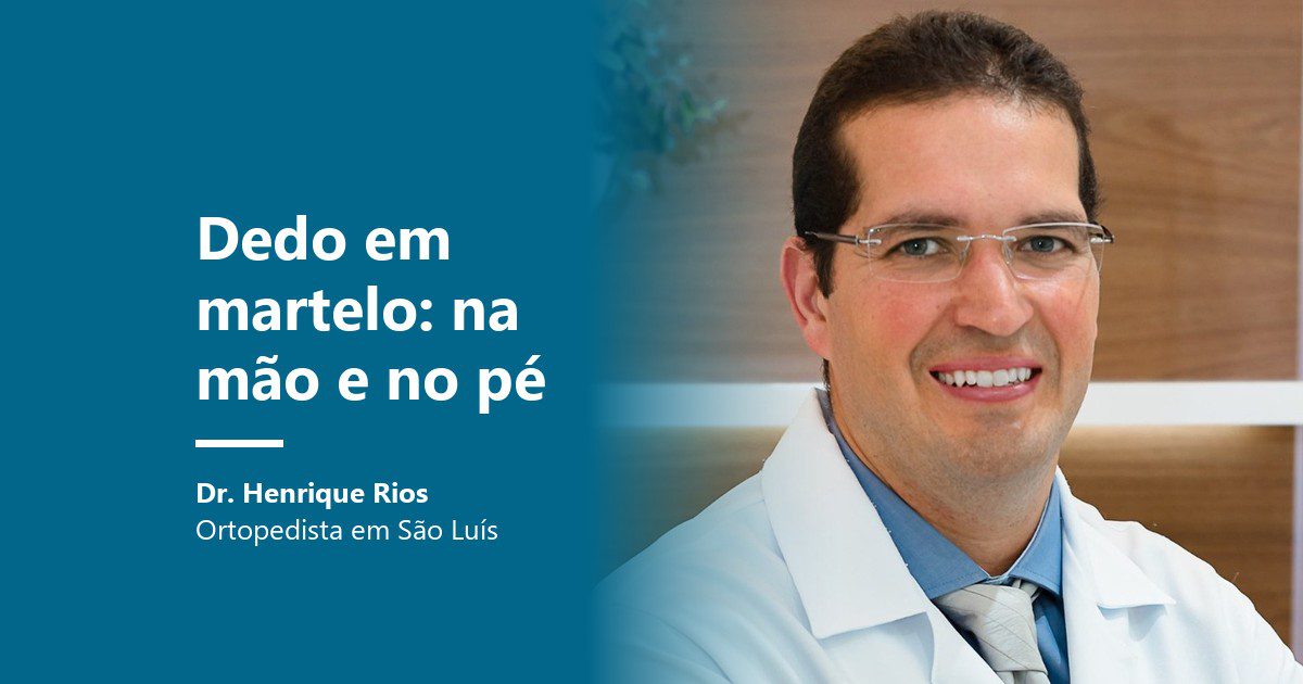 Dedo em martelo: Dr. Henrique Rios, ortopedista em São Luís
