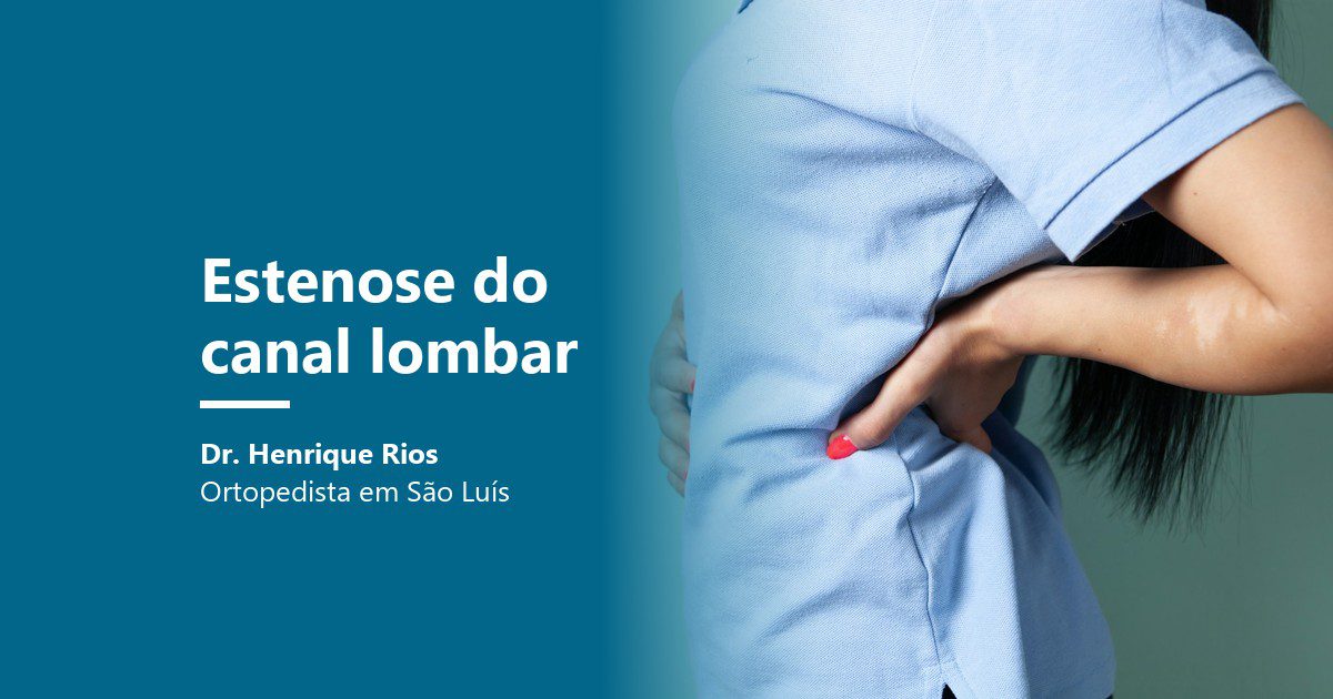 Estenose do canal lombar: mão na região lombar