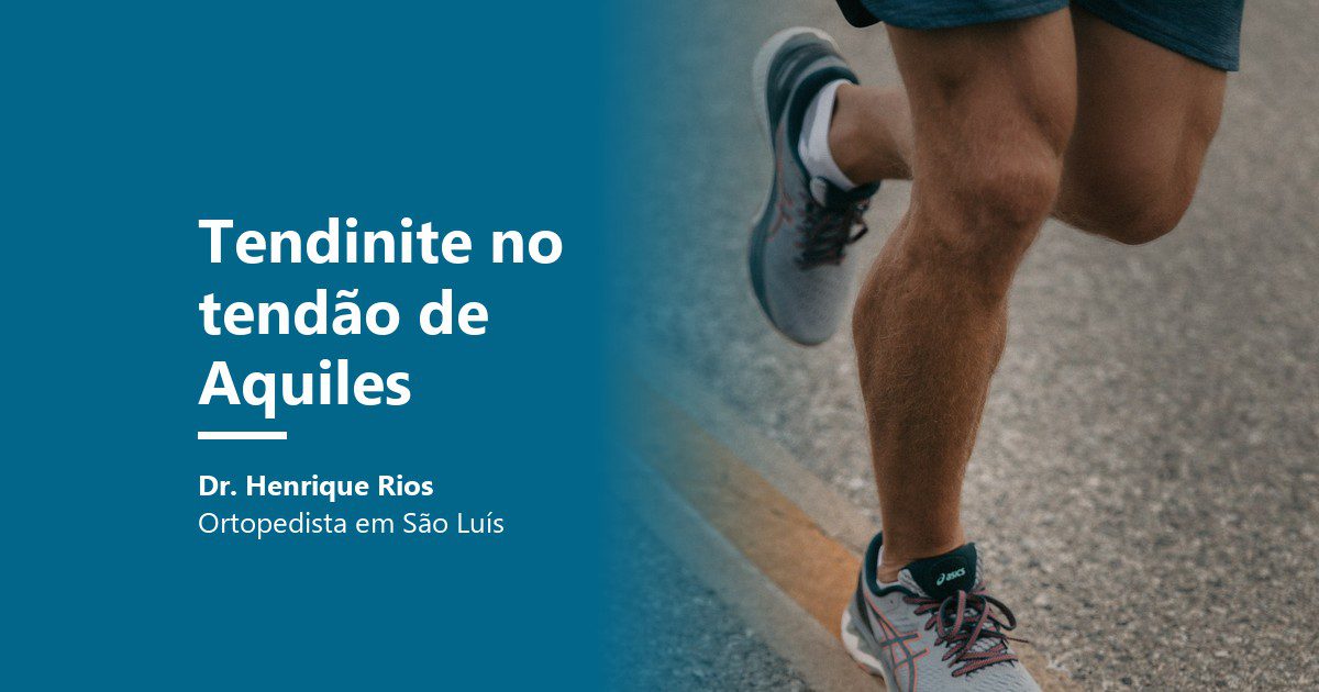 Tendinite no tendão de Aquiles: corredor na rua