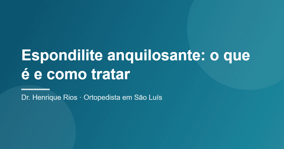 Espondilite Anquilosante