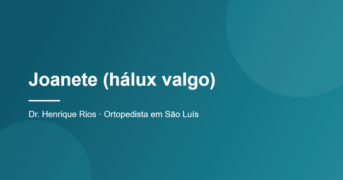 Joanete (hálux valgo), Dr. Henrique Rios, ortopedista em São Luís