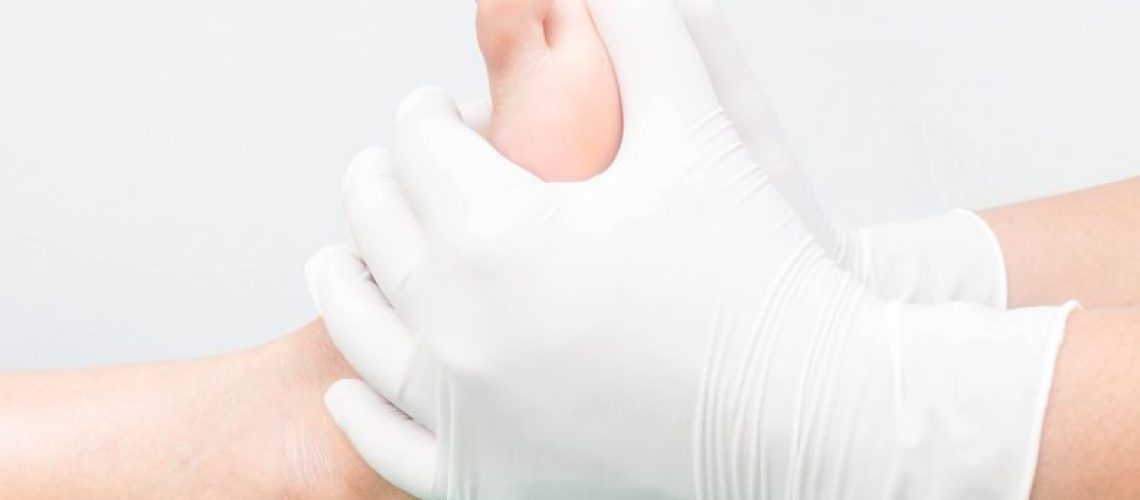 artropatia de charcot