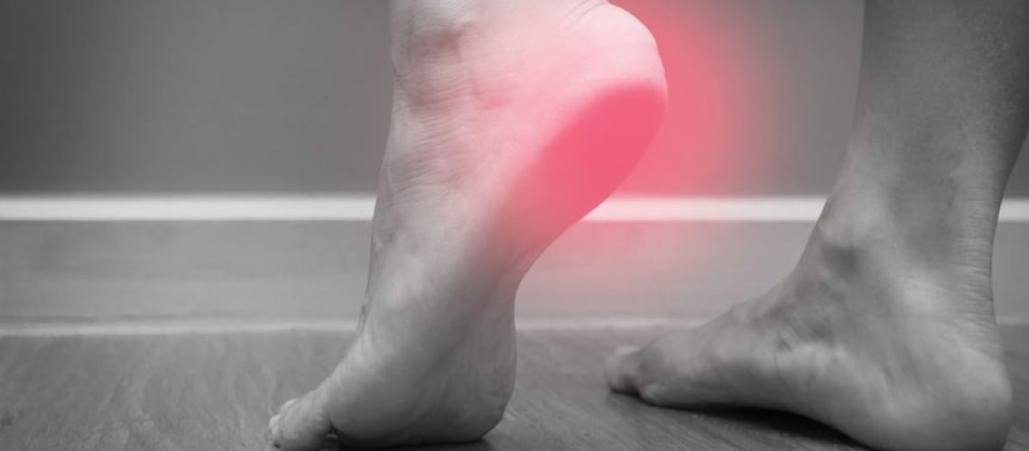 Esporão de calcâneo