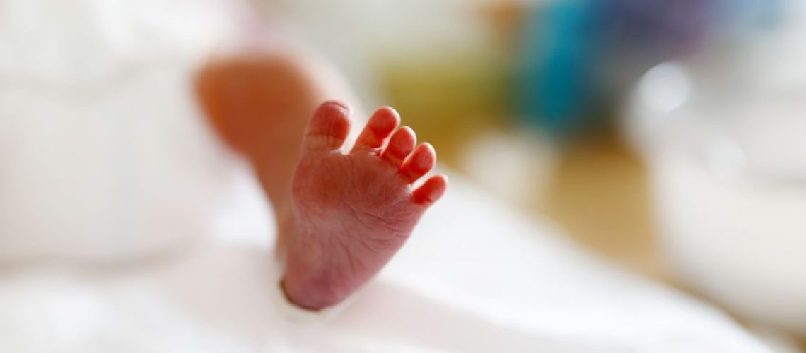 Osteogênese imperfeita