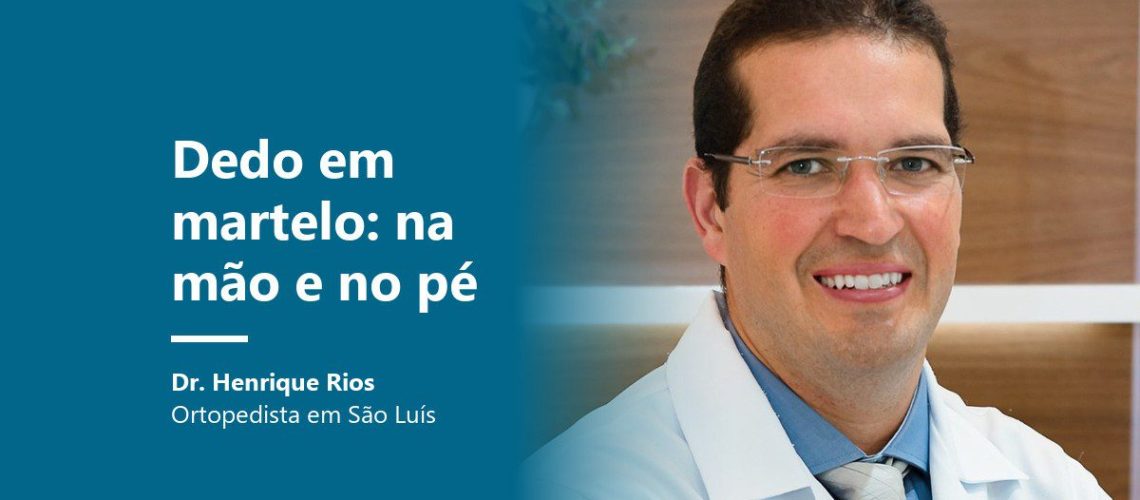 Dedo em martelo: Dr. Henrique Rios, ortopedista em São Luís