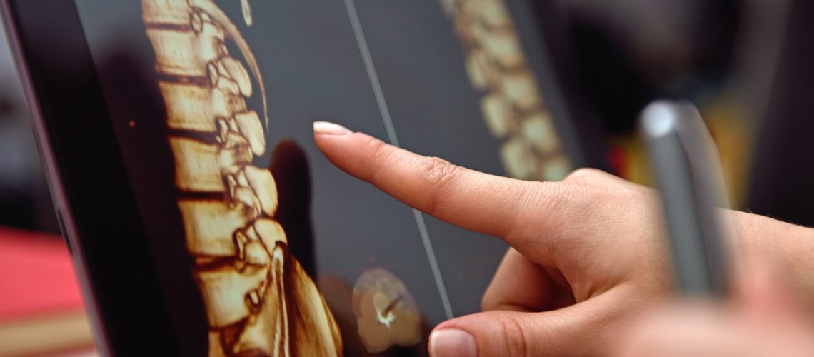 um-guia-anatomicamente-correto-da-coluna-vertebral-20180523172408.jpg[1]